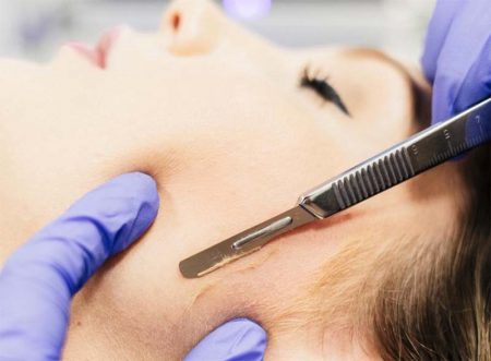 DERMAPLANING
